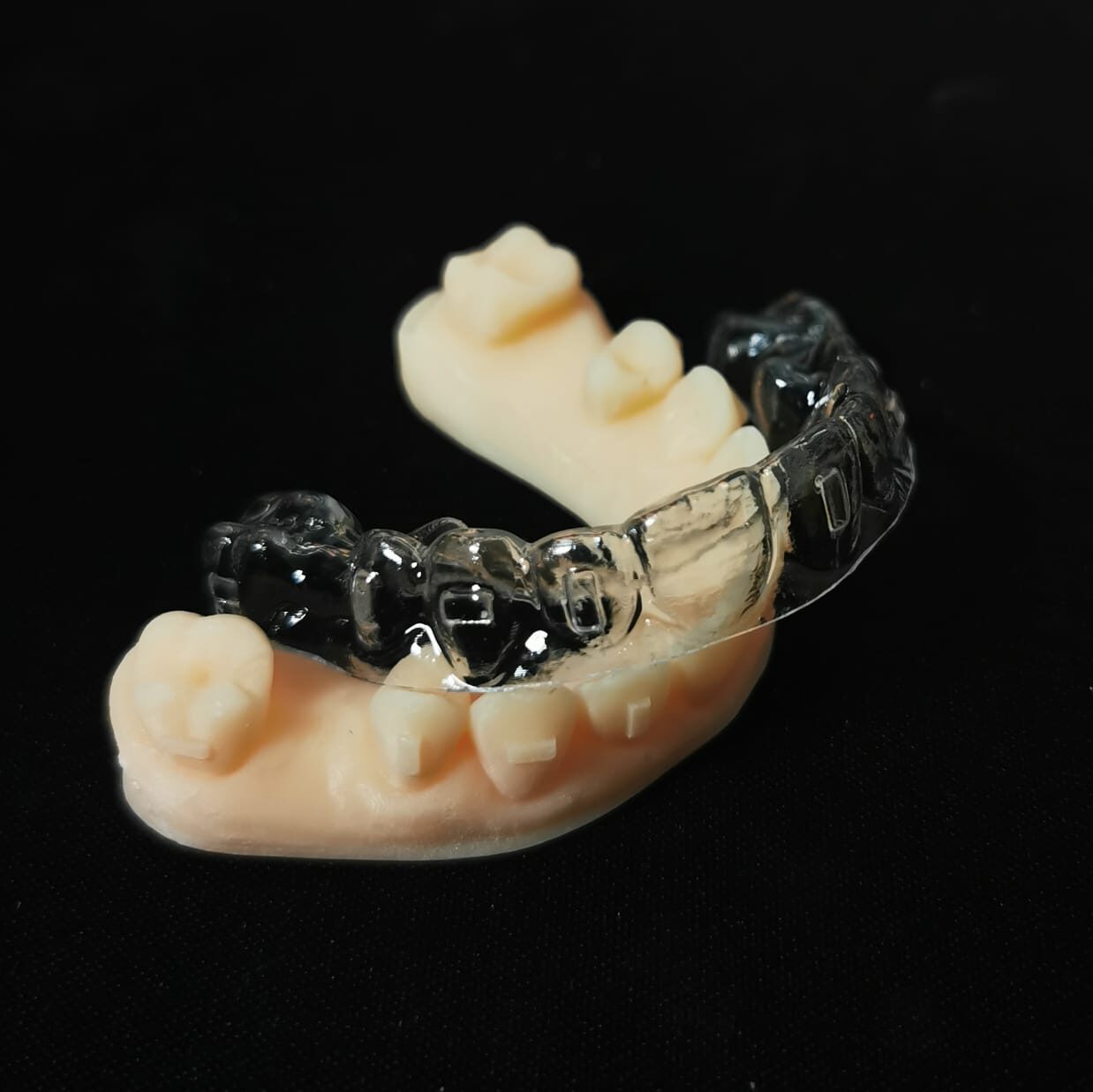 Gutiera aliniere